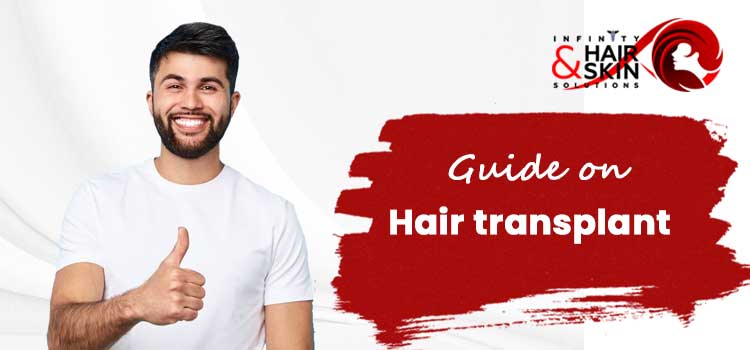 Guide-on-hair-transplant-INFINITY-JPG