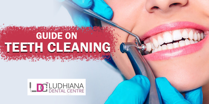 Guide-on-teeth-cleaning