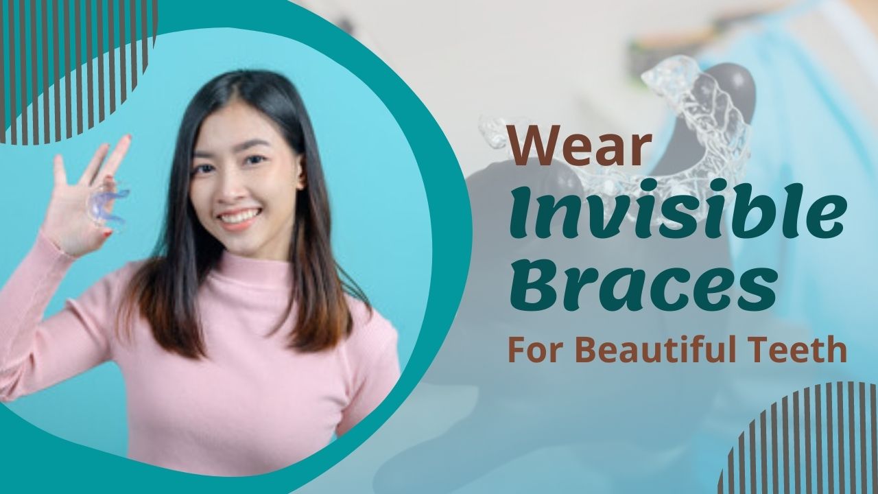 Wear Invisible Braces For Beautiful Teeth