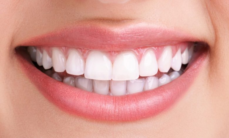 can teeth whitening damage gums