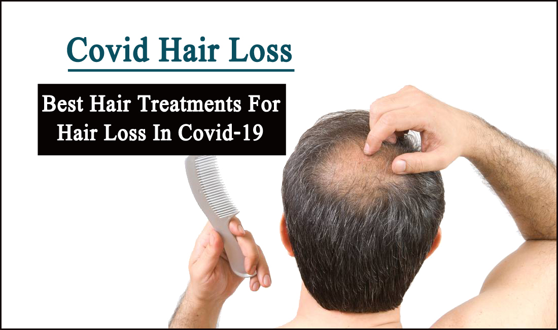 covid hair loss- What are the Best Hair Treatments for Hair loss in Covid-19?