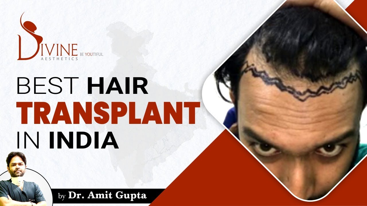 Hair Transplant Surgery