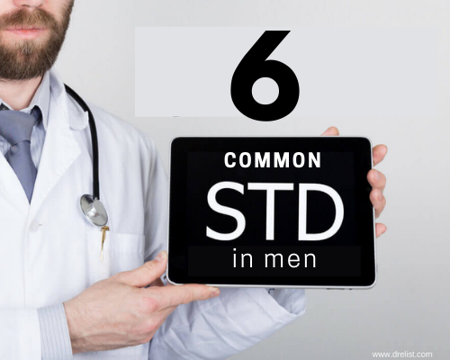 Photo of 6 Common STDs in Men: Symptoms, Treatment and Prevention