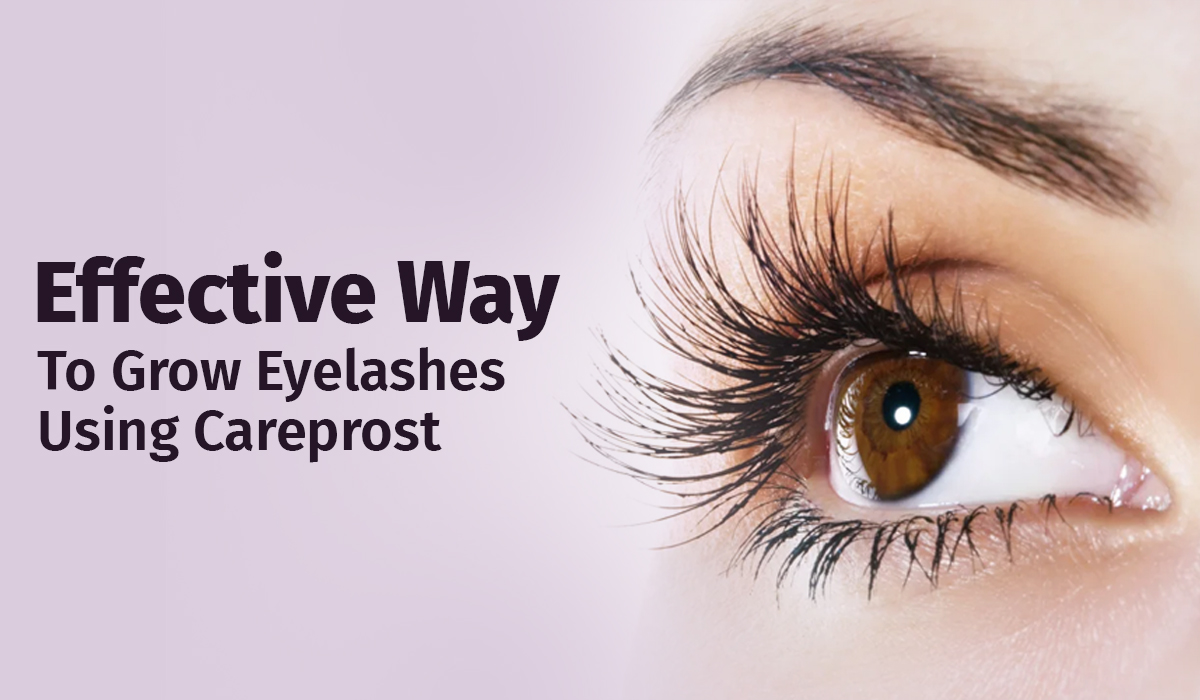 Photo of Effective Way To Grow Eyelashes Using Careprost