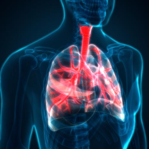 lung cancer metastasis to the brain