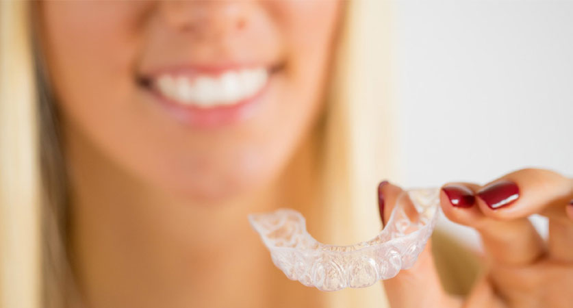 Invisalign