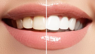 naturally whiten teeth