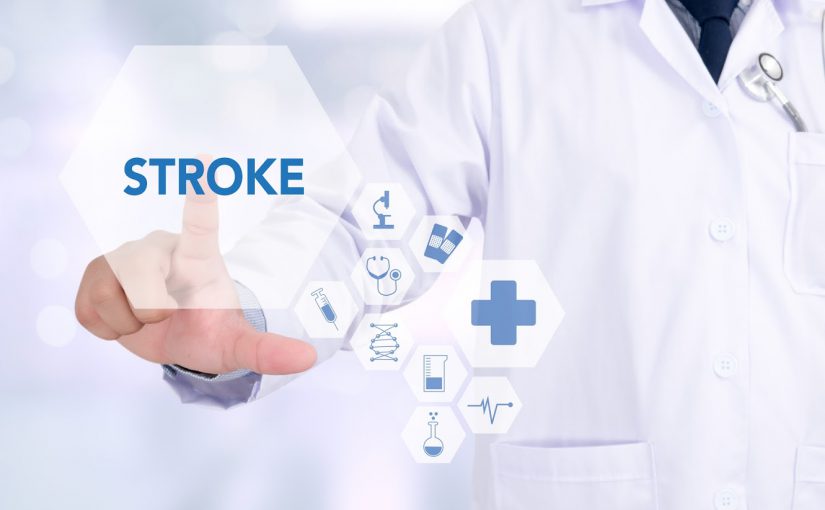 Explain the latest technology tools to decline stroke effects?