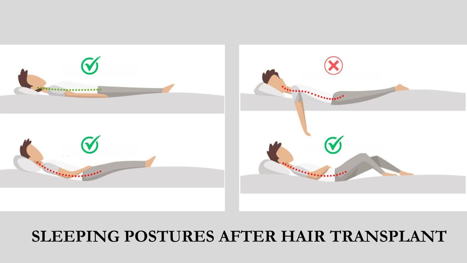 transplant-sleeping-positions